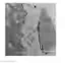 Fig. 01 - Implantable devices for bone or joint defects
