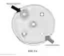 Fig. 06 - Implantable devices for bone or joint defects
