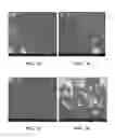 Fig. 09 - Implantable devices for bone or joint defects