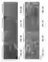 Fig. 10 - Implantable devices for bone or joint defects