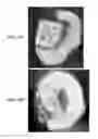 Fig. 24 - Implantable devices for bone or joint defects