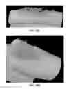Fig. 25 - Implantable devices for bone or joint defects