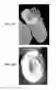 Fig. 26 - Implantable devices for bone or joint defects