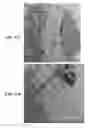 Fig. 27 - Implantable devices for bone or joint defects