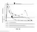 Fig. 29 - Implantable devices for bone or joint defects