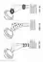 Fig. 31 - Implantable devices for bone or joint defects