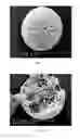 Fig. 04 - Micro-needle and micro-needle patch