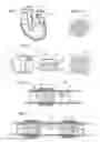 Fig. 02 - Heart help pump, system, and method