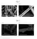 Fig. 02 - Blood filter and method for manufacturing the same
