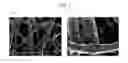 Fig. 03 - Blood filter and method for manufacturing the same
