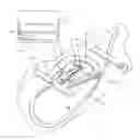 Fig. 01 - Intravenous needle and Luer fitting securement
