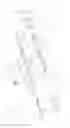 Fig. 16 - Drive and dosing device with a stop element for preventing the setting of a dose