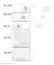 Fig. 50 - Device and method for aerosolized delivering of substance to a natural orifice of the body