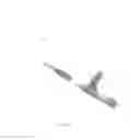 Fig. 02 - Catheter devices, systems and methods for injection of adhesive materials