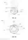 Fig. 06 - Catheter devices, systems and methods for injection of adhesive materials