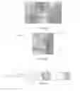 Fig. 08 - Catheter devices, systems and methods for injection of adhesive materials