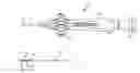 Fig. 01 - Printed electrode catheter