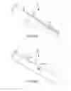 Fig. 08 - Printed electrode catheter