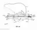 Fig. 04 - Recovery catheter assembly