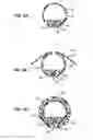 Fig. 06 - Recovery catheter assembly