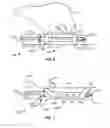 Fig. 07 - Recovery catheter assembly