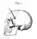 Fig. 02 - METHOD TO OPTIMIZE ELECTRODE PLACEMENT FOR CRANIAL ELECTRICAL STMULATION