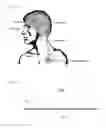 Fig. 02 - Bio-implantable electrode assembly