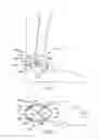 Fig. 03 - Tibial nerve stimulation device
