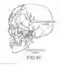 Fig. 07 - Devices, systems and methods for treatment of neuropsychiatric disorders