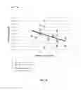 Fig. 11 - Neurostimulation titration utilizing T-wave alternans