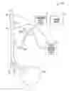Fig. 01 - Methods and apparatus for adjusting neurostimulation intensity using evoked responses