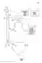 Fig. 02 - Methods and apparatus for adjusting neurostimulation intensity using evoked responses
