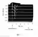 Fig. 08 - Methods and apparatus for adjusting neurostimulation intensity using evoked responses