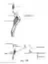 Fig. 11 - Methods for generating waveform shapes optimized for energy efficiency for treating neurological disorders
