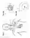 Fig. 02 - Neurostimulation titration process via adaptive parametric modification