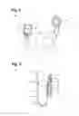 Fig. 03 - Neurostimulation titration process via adaptive parametric modification