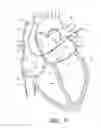 Fig. 12 - METHOD FOR DETECTING, DIAGNOSING, AND TREATING CARDIOVASCULAR DISEASE