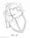 Fig. 17 - METHOD FOR DETECTING, DIAGNOSING, AND TREATING CARDIOVASCULAR DISEASE