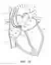 Fig. 18 - METHOD FOR DETECTING, DIAGNOSING, AND TREATING CARDIOVASCULAR DISEASE