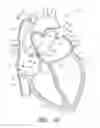 Fig. 19 - METHOD FOR DETECTING, DIAGNOSING, AND TREATING CARDIOVASCULAR DISEASE