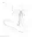 Fig. 09 - Therapy device for edema and neuropathy