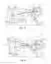 Fig. 07 - Exercise apparatus