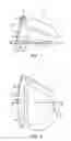 Fig. 02 - Golf club head with flexure