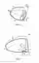 Fig. 04 - Golf club head with flexure