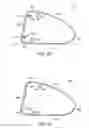 Fig. 13 - Golf club head with flexure