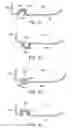 Fig. 18 - Golf club head with flexure