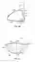Fig. 20 - Golf club head with flexure