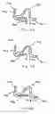 Fig. 35 - Golf club head with flexure