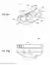 Fig. 17 - Golf club head