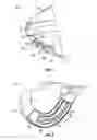 Fig. 04 - Golf club head with adjustable center of gravity